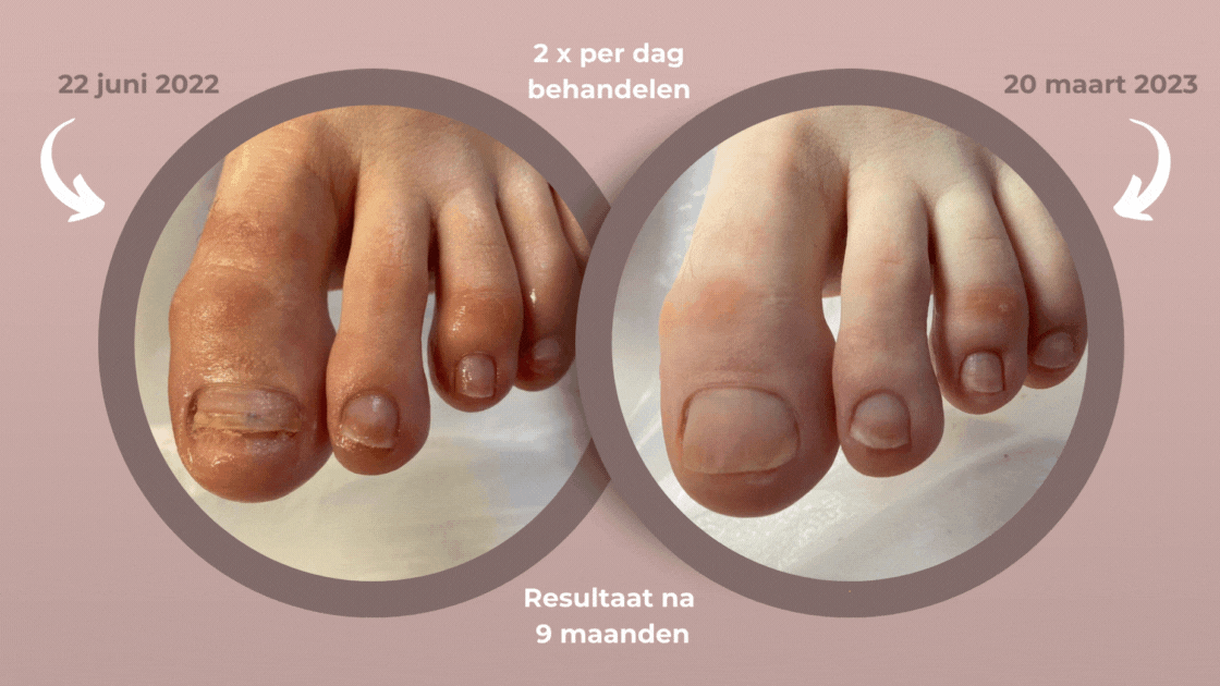Dé praktijk voor jouw voetverzorging! (1)